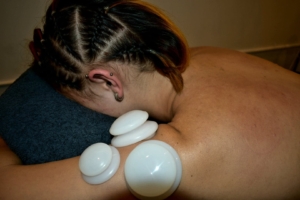 Cupping available at Seashelle Massage