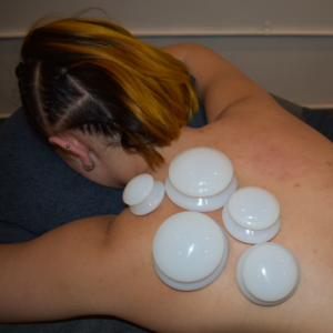 Myofascial cupping on back of shoulder