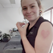 Cupping on arm with plastic heart